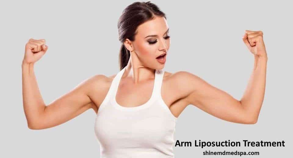 Things you should know before arm liposuction l ShineMD Medspa