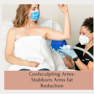 Coolsculpting Arms