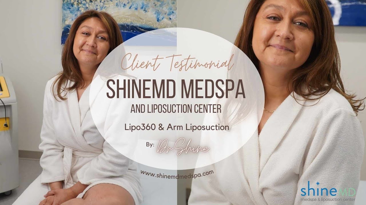 How do you feel after having Lipo360 & Arm Lipo? | ShineMD Client Testimonial